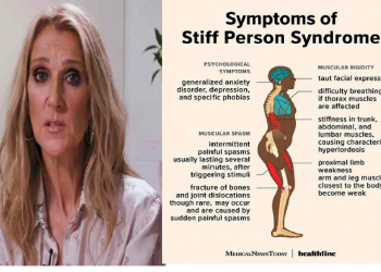 La maladie rare de CELINE DION :  c&rsquo;est quoi Stiff-Person Syndrome ( le syndrome de la personne raide ) ?