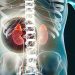 UNE HYPERTENSION ARTERIELLE RESISTANTE A TOUS LES TRAITEMENTS : PROBLEME DES GLANDES SURRENALES ? LE ROLE DU STRESS ?