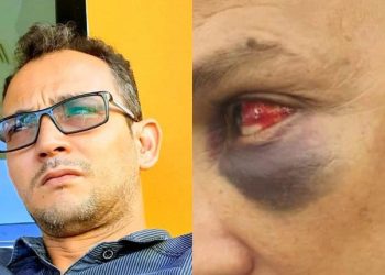 Agression contre un Conseiller Communal