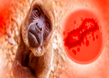 Variole de Singe en hausse en Afrique