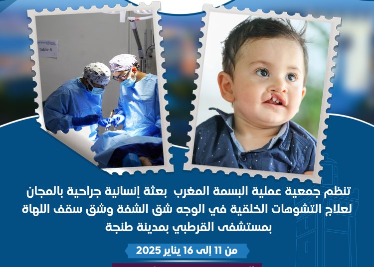 Une compagne humanitaire contre les malformations congénitales à Tanger